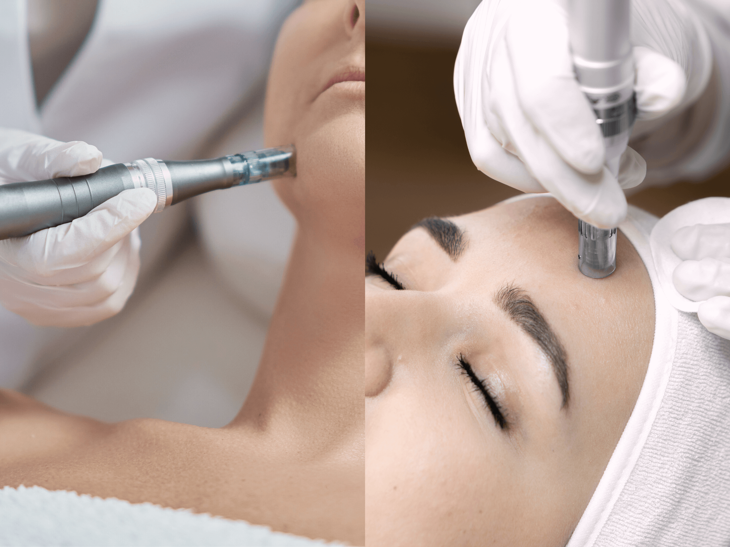 Mesotherapie