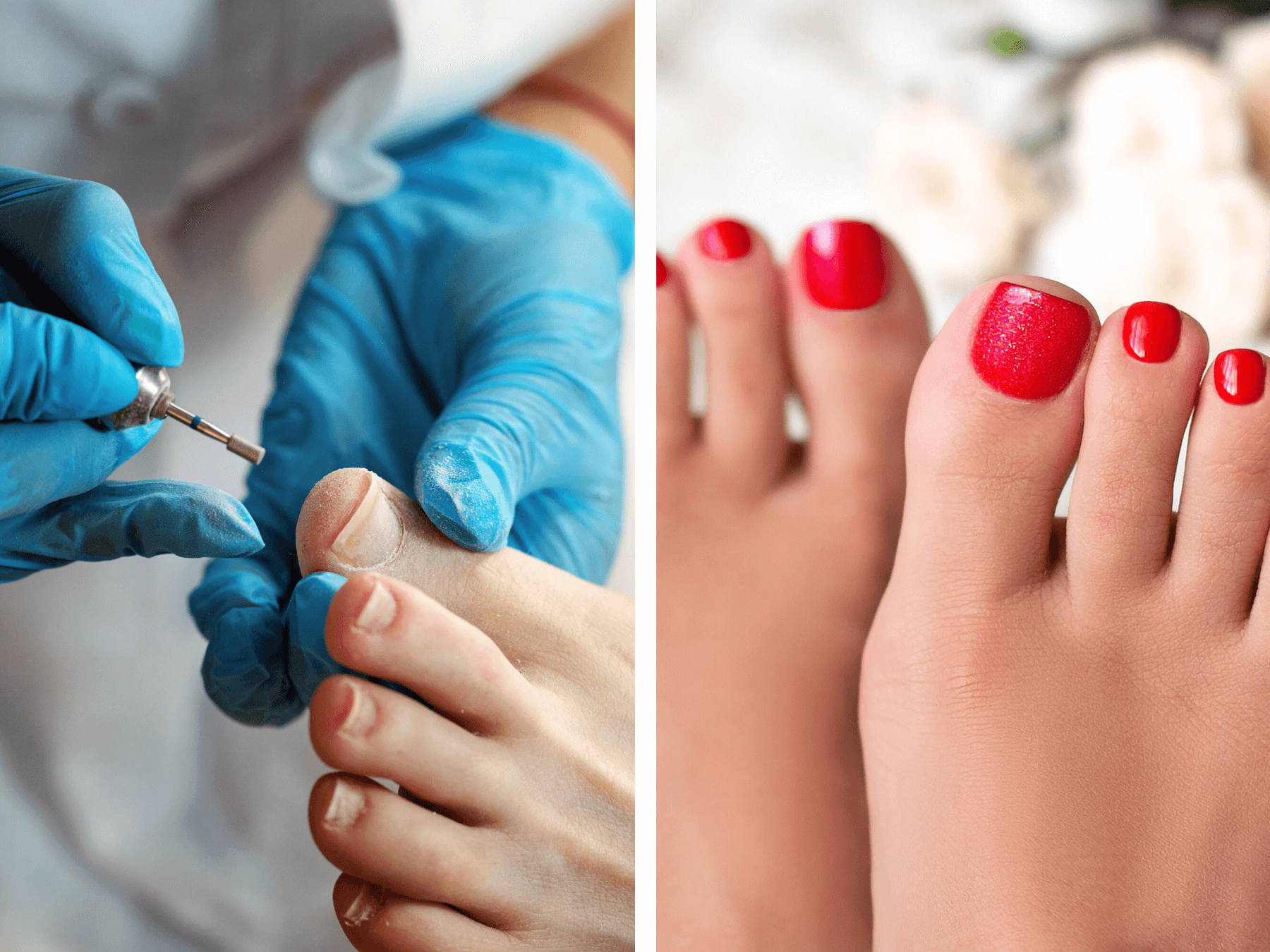 pedicure Zoetermeer